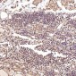 Anti-BNIP3 Rabbit Monoclonal Antibody
